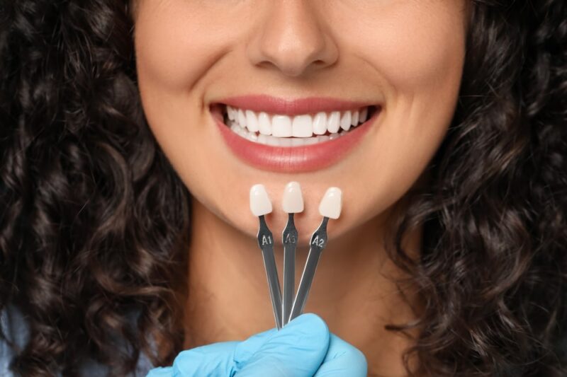 Cosmetic Dentistry in Gilbert